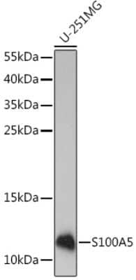 Western Blot: S100A5 AntibodyAzide and BSA Free [NBP2-93842]